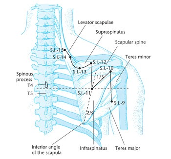 IG12 Бин-фэн (si 12)